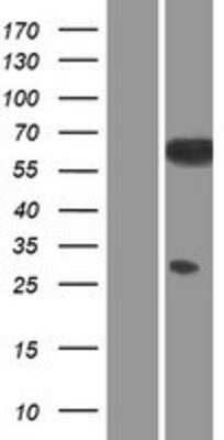 Western Blot: Src Overexpression Lysate [NBP2-04722]