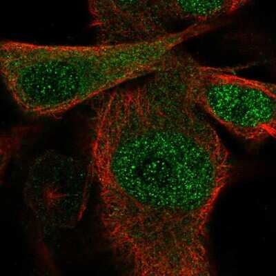 Immunocytochemistry/ Immunofluorescence: Ssu72 Antibody [NBP2-57318]