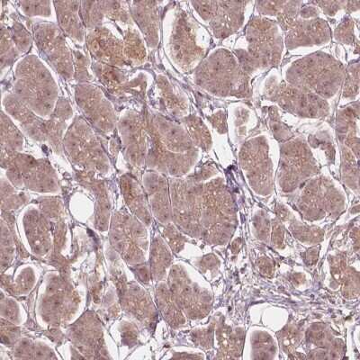Immunohistochemistry-Paraffin: Ssu72 Antibody [NBP2-49591]