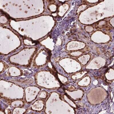 Immunohistochemistry-Paraffin: Ssu72 Antibody [NBP2-49591]