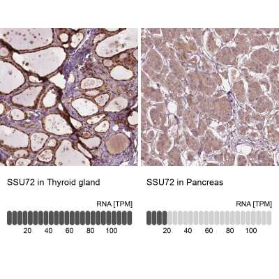 Immunohistochemistry-Paraffin: Ssu72 Antibody [NBP2-49591]