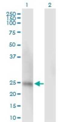 Western Blot: Ssu72 Antibody [H00029101-B01P]