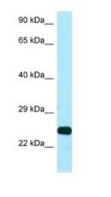 Western Blot: Ssu72 Antibody [NBP1-98498]