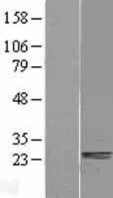 Western Blot: Ssu72 Overexpression Lysate [NBL1-16482]