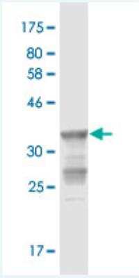 Western Blot: StAR Antibody (2B5) [H00006770-M10]