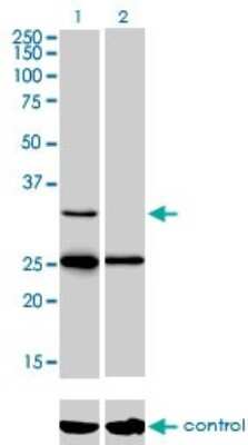 Western Blot: StAR Antibody (5F9) [H00006770-M01]