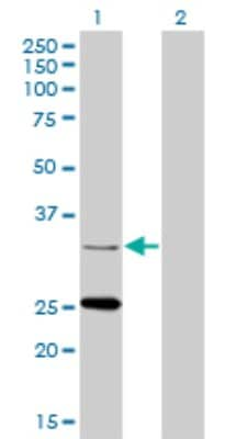 Western Blot: StAR Antibody (5F9) [H00006770-M01]