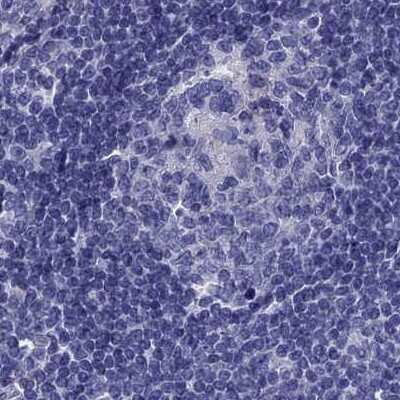 Immunohistochemistry-Paraffin: StAR Antibody [NBP1-86992]