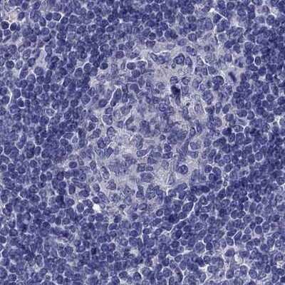 Immunohistochemistry-Paraffin: StAR Antibody [NBP1-86993]