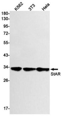 Western Blot: StAR Antibody (S04-5G9) [NBP3-19536]