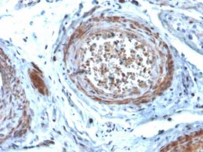 Immunohistochemistry-Paraffin: StAR Antibody (STAR/2077) - Azide and BSA Free [NBP3-08547]