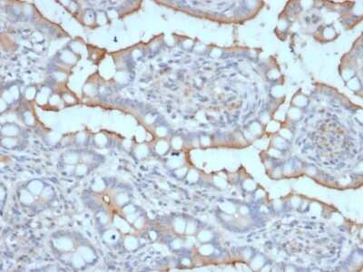 Immunohistochemistry-Paraffin: StAR Antibody (STAR/2077) - Azide and BSA Free [NBP3-08547]