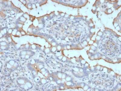 Immunohistochemistry-Paraffin: StAR Antibody (STAR/2077) [NBP3-07308]