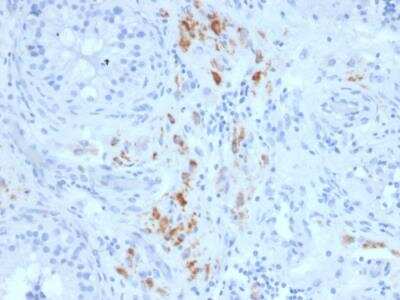 Immunohistochemistry-Paraffin: StAR Antibody (STAR/2140) - Azide and BSA Free [NBP2-75740]