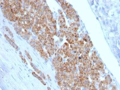 Immunohistochemistry-Paraffin: StAR Antibody (STAR/2140) [NBP2-75739]