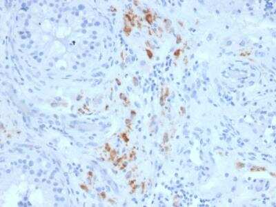 Immunohistochemistry-Paraffin: StAR Antibody (STAR/2140) [NBP2-75739]