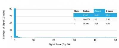 Protein Array: StAR Antibody (STAR/2140) [NBP2-75739]
