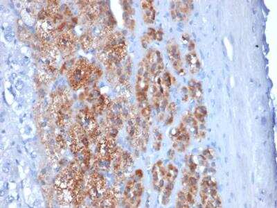 Immunohistochemistry-Paraffin: StAR Antibody (STAR/2154) - Azide and BSA Free [NBP2-75742]