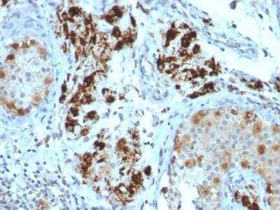 Immunohistochemistry-Paraffin: StAR Antibody (STAR/2154) - Azide and BSA Free [NBP2-75742]