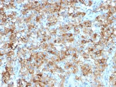 Immunohistochemistry-Paraffin: StAR Antibody (STAR/2154) - Azide and BSA Free [NBP2-75742]