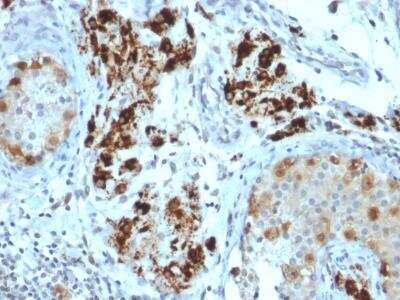 Immunohistochemistry-Paraffin: StAR Antibody (STAR/2154) [NBP2-75741]