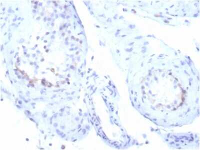 Immunohistochemistry-Paraffin: StAR Antibody (STAR/3915R) [NBP3-13786]