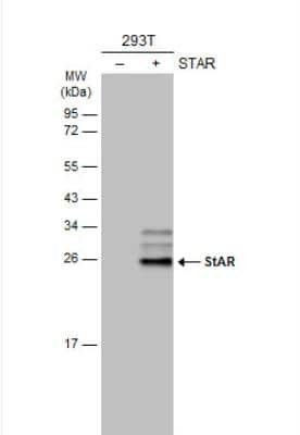 Western Blot: StAR Antibody [NBP1-33485]