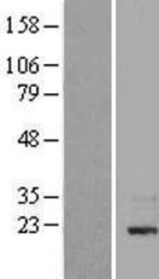 Western Blot: StAR Overexpression Lysate [NBP2-09031]