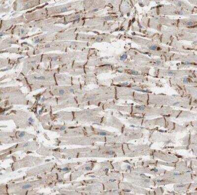 Immunohistochemistry-Paraffin: Stabilin-1 Antibody [NBP1-84444]