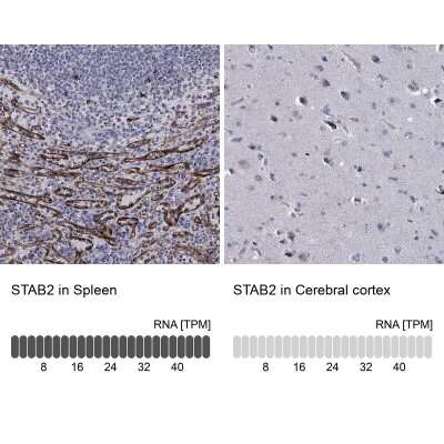 Immunocytochemistry/ Immunofluorescence: Stabilin-2 Antibody [NBP3-17092]