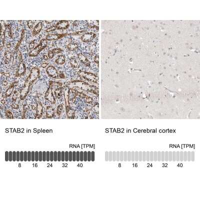Immunohistochemistry-Paraffin: Stabilin-2 Antibody [NBP1-84197]