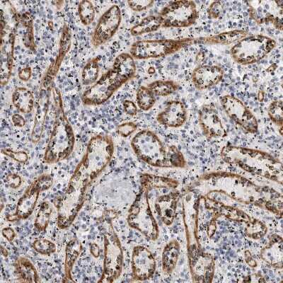 Immunohistochemistry-Paraffin: Stabilin-2 Antibody [NBP1-84197]
