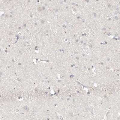 Immunohistochemistry-Paraffin: Stabilin-2 Antibody [NBP1-84197]