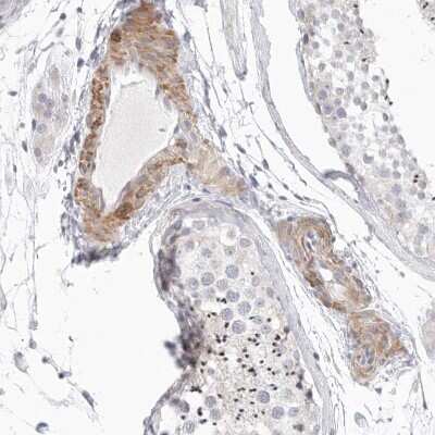 Immunohistochemistry-Paraffin: Stabilin-2 Antibody [NBP1-84197]