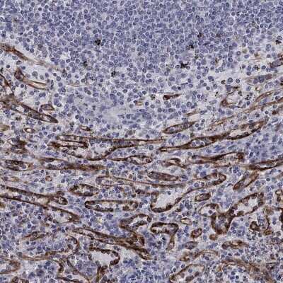 Immunohistochemistry-Paraffin: Stabilin-2 Antibody [NBP3-17092]