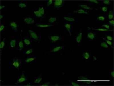 Immunocytochemistry/ Immunofluorescence: Stanniocalcin 1/STC-1 Antibody (1A3) [H00006781-M02]