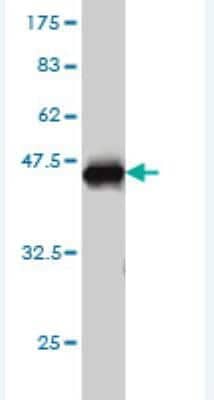 Western Blot: Stanniocalcin 1/STC-1 Antibody (4H4) [H00006781-M01]