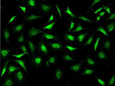 Immunocytochemistry/ Immunofluorescence: Stanniocalcin 1/STC-1 Antibody [NBP2-97047]