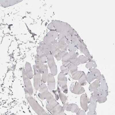 Immunohistochemistry-Paraffin: Stanniocalcin 1/STC-1 Antibody [NBP1-87816]