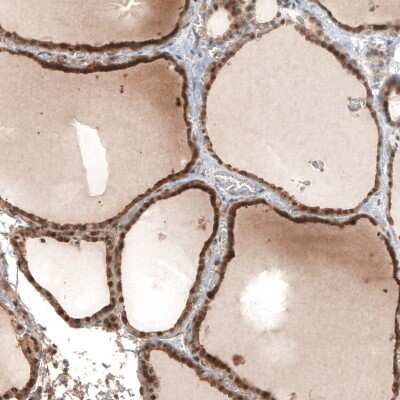 Immunohistochemistry-Paraffin: Stanniocalcin 1/STC-1 Antibody [NBP1-87816]