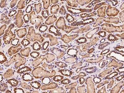 Immunohistochemistry-Paraffin: Stanniocalcin 1/STC-1 Antibody [NBP2-97047]