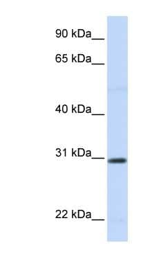 Western Blot: Stanniocalcin 1/STC-1 Antibody [NBP1-59310]