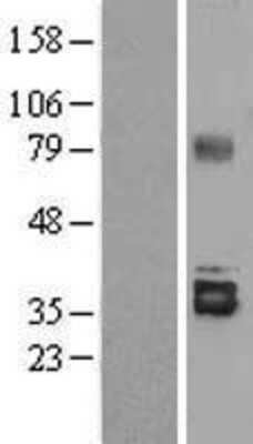 Western Blot: Stanniocalcin 2/STC-2 Overexpression Lysate [NBL1-16534]