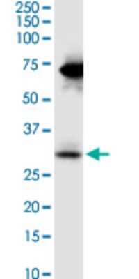 Western Blot: Stanniocalcin 2/STC-2 Antibody (2B11) [H00008614-M08]