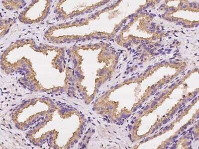 Immunohistochemistry-Paraffin: Stanniocalcin 2/STC-2 Antibody [NBP2-98008]