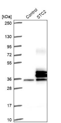 Western Blot: Stanniocalcin 2/STC-2 Antibody [NBP1-92447]