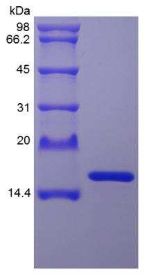 SDS-PAGE: Recombinant Staphylokinase Protein [NBP2-35312]
