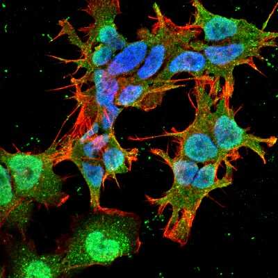 Immunocytochemistry/ Immunofluorescence: Stargazin Antibody (S245-36) [NBP2-22411]