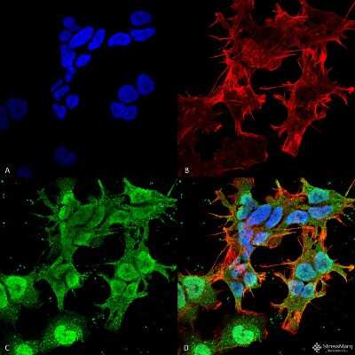 Immunocytochemistry/ Immunofluorescence: Stargazin Antibody (S245-36) [NBP2-22411]