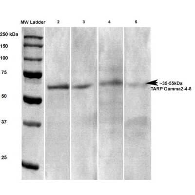 Western Blot: Stargazin Antibody (S245-36) [NBP2-22411]